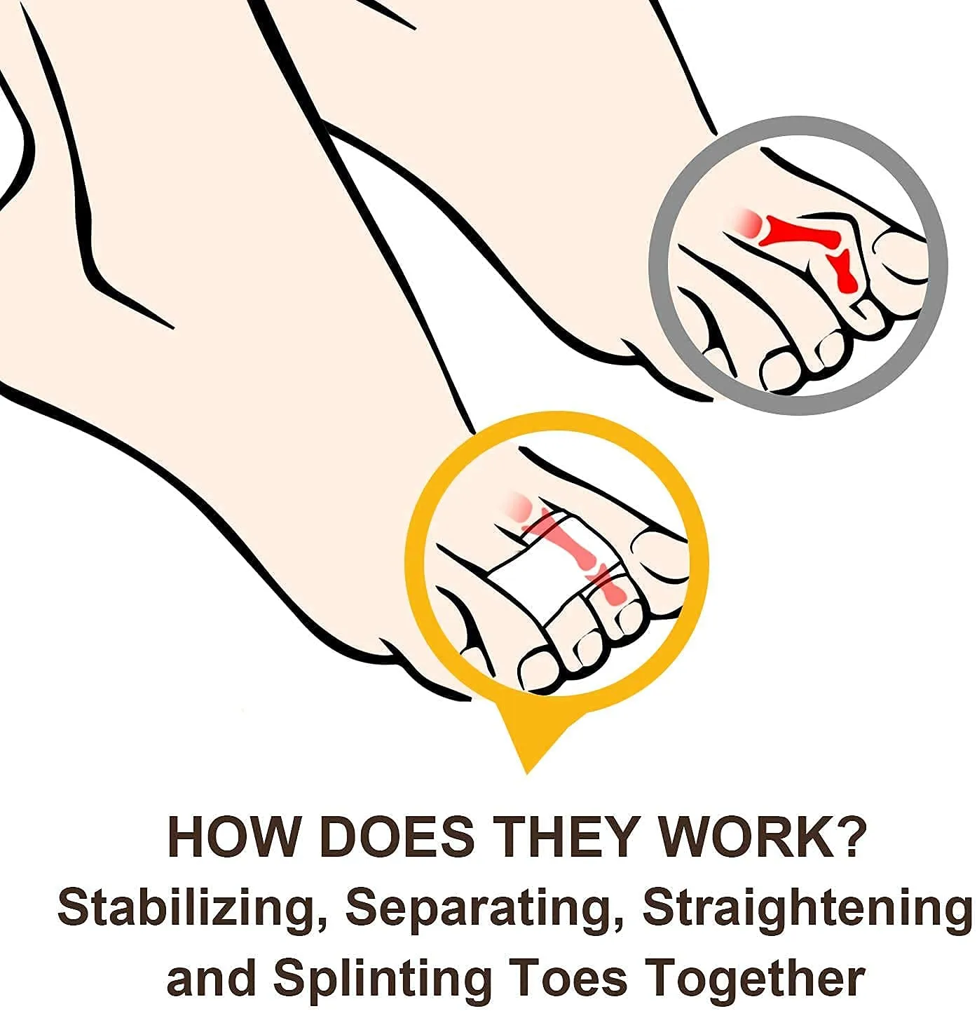 6 Pcs Hammer Toe Straightener, Hammer Toe Splints, Crooked Toes & Overlapping Toes，Protecting Curved Toes and Hammertoes, Overlapping Toe Protector，Toe Cushioned Bandages for Correcting Hammer Toes
